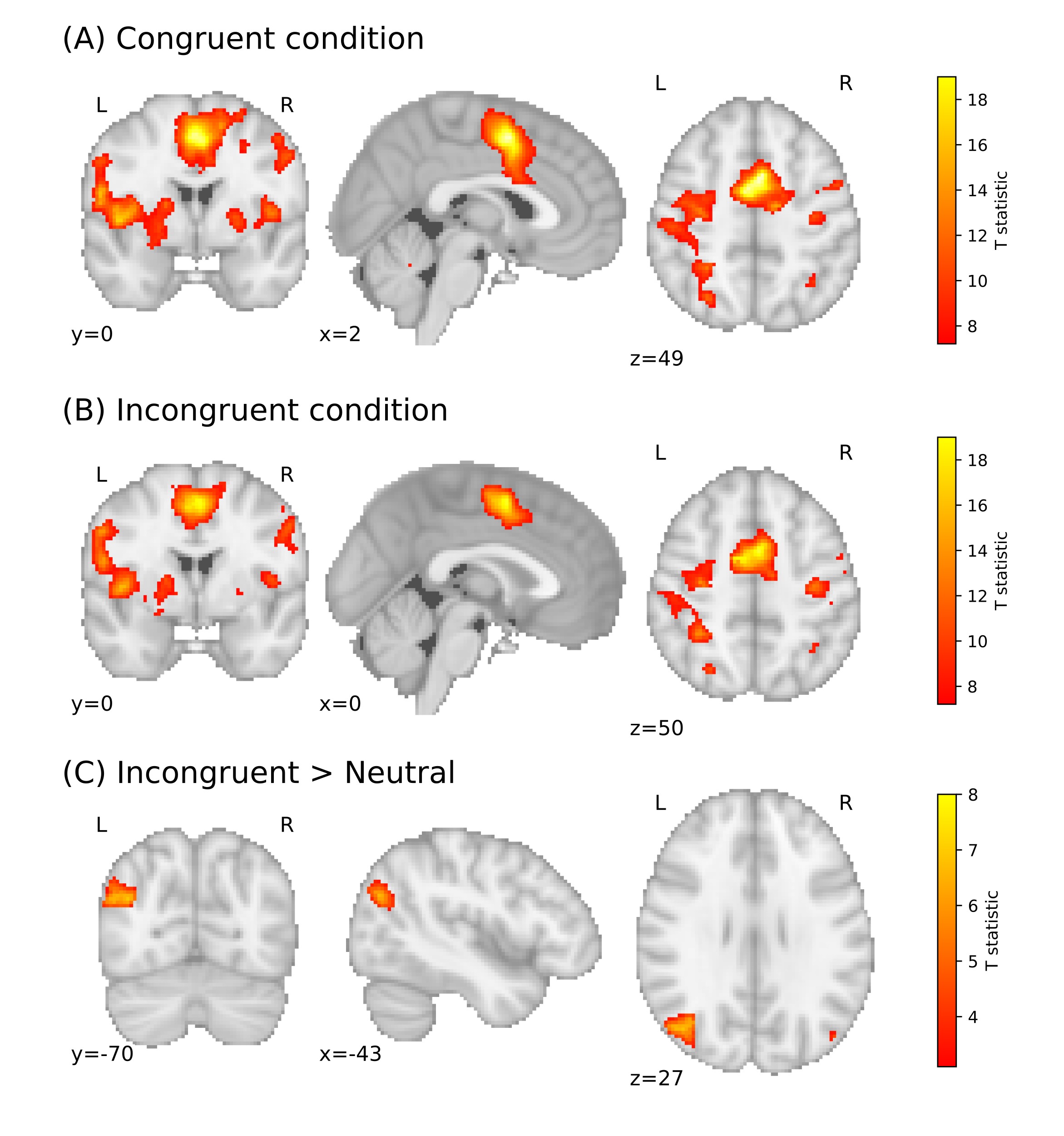 Publikacja naukowa Małgorzaty Gut i Karoliny Finc dotycząca mózgowego podłoża efektu SNARC